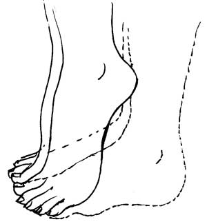 Ankle and Foot Exercise 3